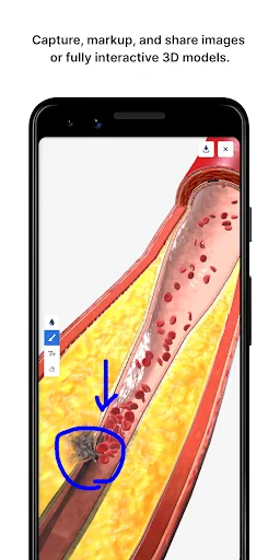 Download BioDigital Human 3D Anatomy Terbaru – Belajar Anatomi - Screenshot 5